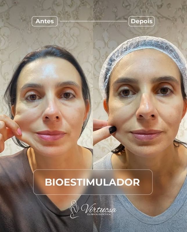 Resultado Bioestimulador