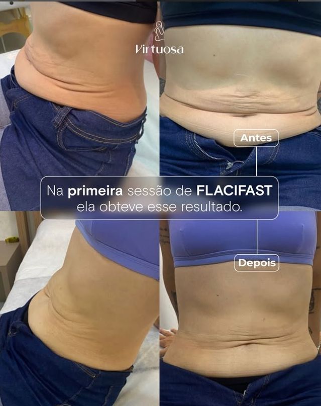 Resultado Flacifast