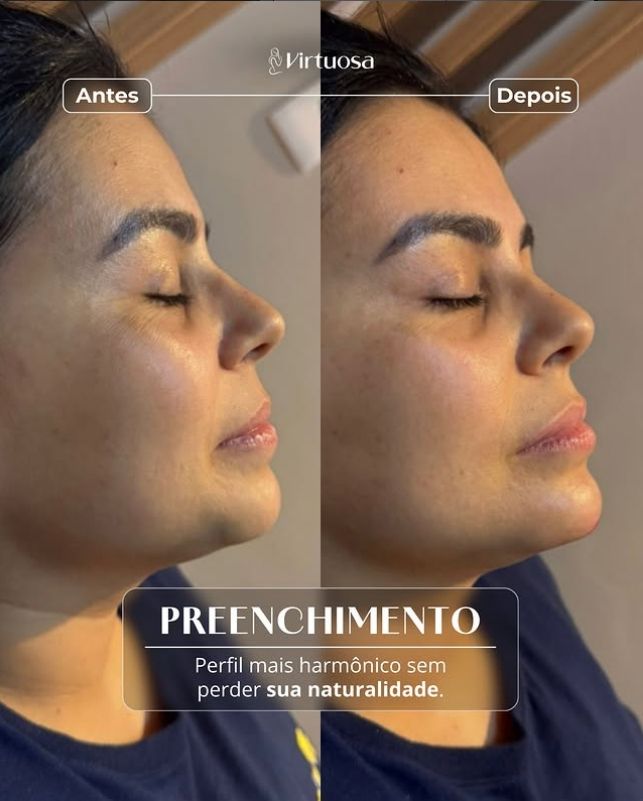 Resultado Preenchimento